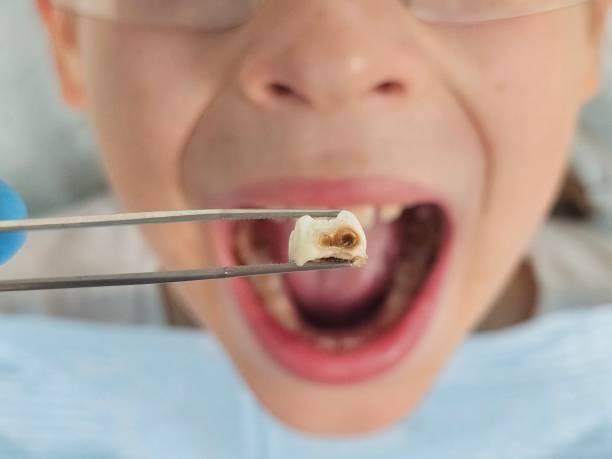 Best Cracked Tooth Emergency Dentist  in Faxon, PA